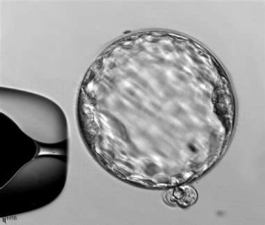 University of Michigan announces creation of embryonic stem cell line ...