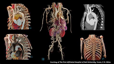 Contrast media - Siemens Healthineers