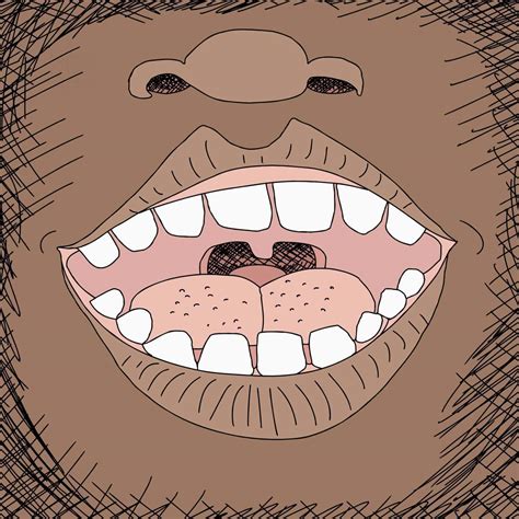 Swollen Taste Bud: 10 Best Reasons To Know - Icy Health