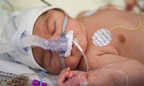 Lung Regeneration: Can Science Give Preterm Babies a Second Breath?