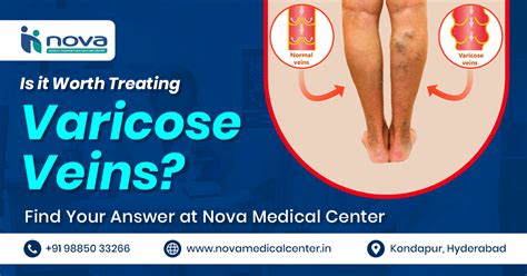 Interventional Radiology - Nova Medical Center