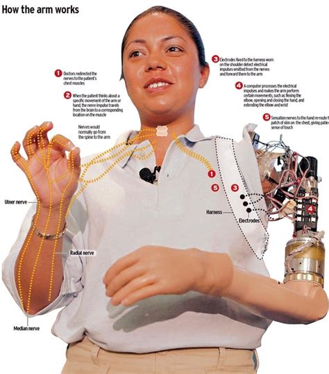 Image result for Bionic Arm Development