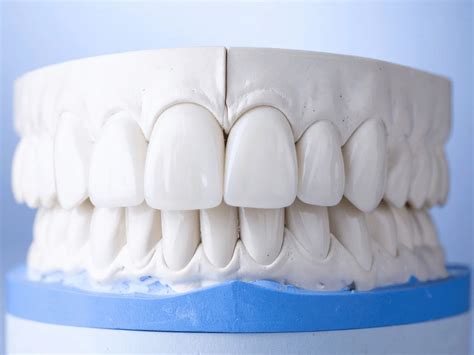 Fixing Protruding Front Teeth: A Complete Guide to Your Treatment Options