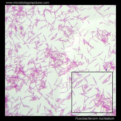 Image result for Urease Enzyme Attoms