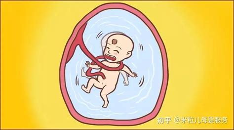 容易造成“脐带绕颈”的4种行为，孕妈要多加注意_胎宝宝