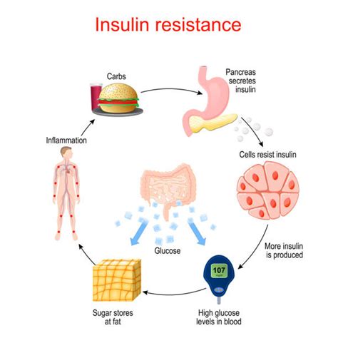 Image result for Insulin Management Algorithm