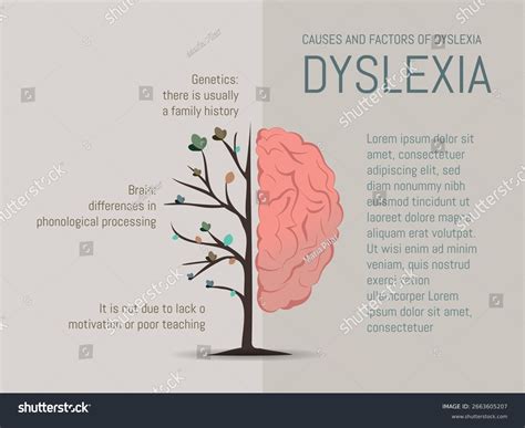 11 Causes Dyslexia Stock Vectors and Vector Art | Shutterstock