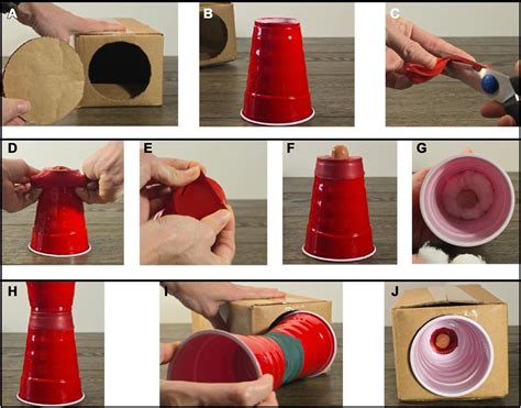 The art of cold knife conization: a demonstration of technique in live patients and a low ...