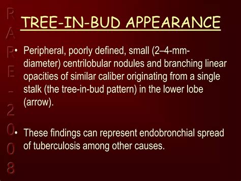 Respiratory system signs final.ppt radiology | PPT