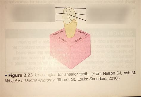Line Angle Teeth 的图像结果