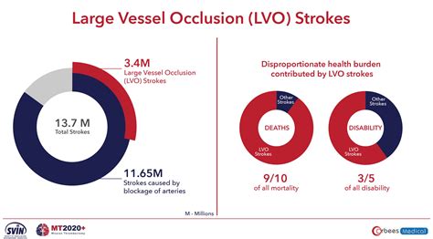 White Paper - Mission Thrombectomy