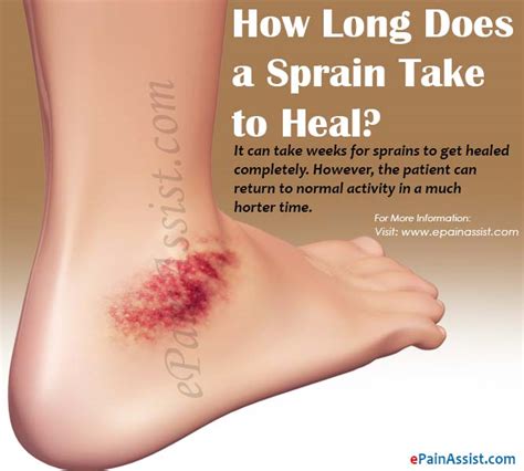 How To Fix A Sprained Ankle At Home