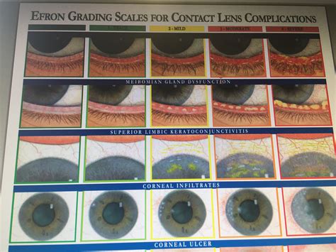 Eye Condition Gpc