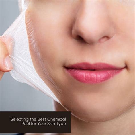 Unlocking a Flawless Complexion: Perfect Chemical Peel | Clinikally