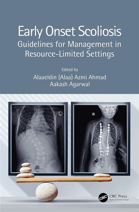 Buy Early Onset Scoliosis: Guidelines for Management in Resource ...