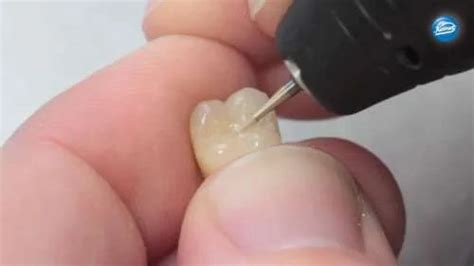 Buy SuperEndo Composite & Porcelain Finishing Bur Kit – Oralkart