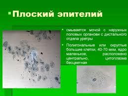 Почечный эпителий в моче у взрослых и детей: причины и лечение