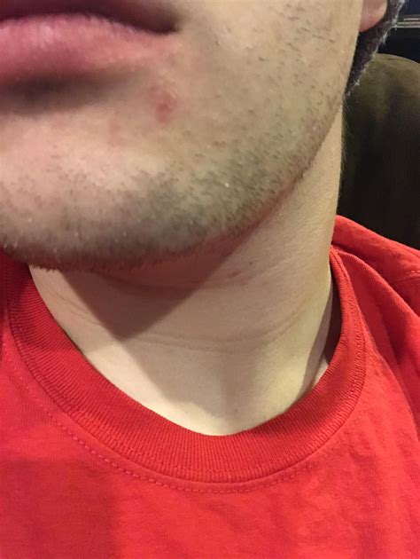 Little Red Dot On Lip - DIY CRAFT
