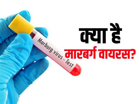 इबोला की तरह ही फैल सकता है मारबर्ग वायरस (Marburg virus), WH0 ने बताया ...