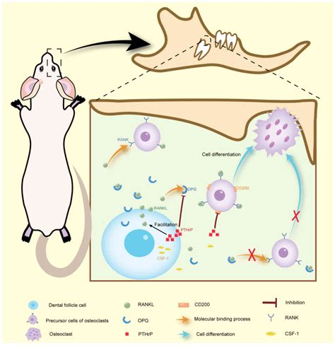 Abnormal dental follicle cells: A crucial determinant in tooth eruption disorders (Review)