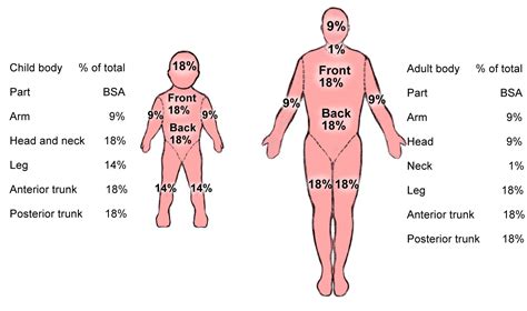 Sci-Study Time: Rule of Nine & Burns | Burns nursing, Physical therapy ...