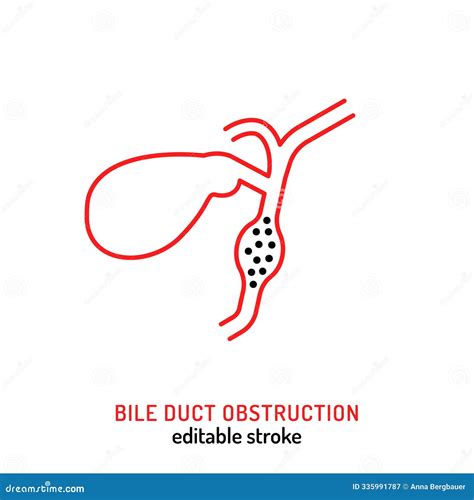 Bile Duct Obstruction Icon in Outline Style. Stock Illustration - Illustration of obstruction ...