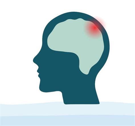 आरोग्य टीप्स: डोकं दुखतंय? घरच्या घरी करा हे ५ सोपे उपाय - India Darpan ...