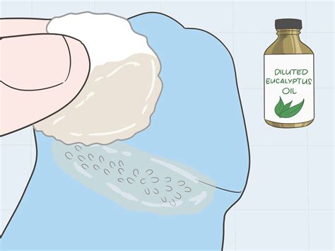 Pearly Penile Papules Removal