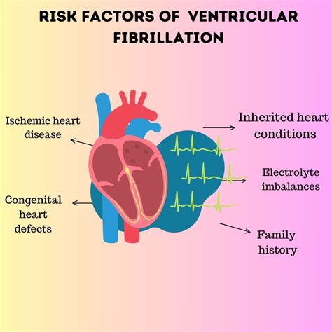 Ventricular tachycardia : Causes, Risk Factors, Symptoms, Treatment
