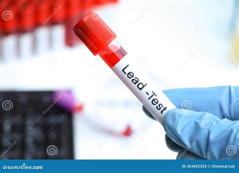 Lead Test To Look for Abnormalities from Blood Stock Image - Image of ...