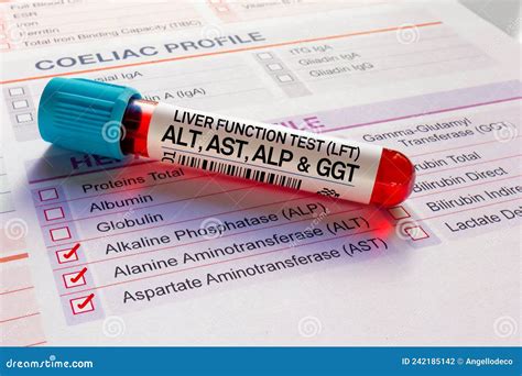Blood Sample Tube for Analysis of LFT Liver Function Tests ALT, AST ...