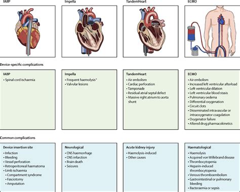 Temporary circulatory support for cardiogenic shock - The Lancet