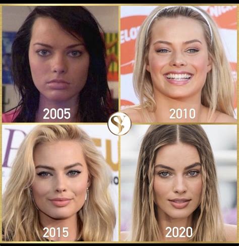 Pin by Krystal Waters on before and after | Celebrity plastic surgery, Margot robbie, Celebs ...
