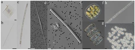 Variations in the Temporal and Spatial Distribution of Microalgae in ...
