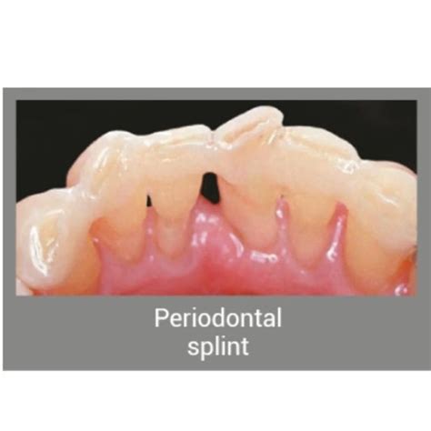 Different Types of Autoclaves for Effective Sterilization – Dental Avenue