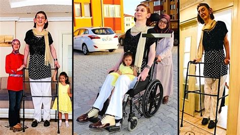 Rumesa Gelgi became the tallest girl in the world surpassing even the ...