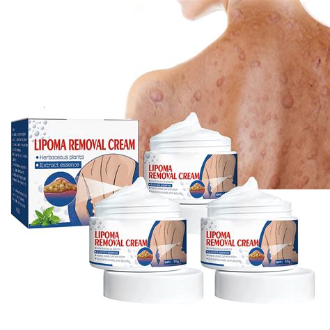 Buy 3Pcs Instant Lipoma Removal Cream, al Lipoma Lumps Removal Cream ...