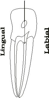 Gaining access to root canals