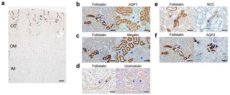Tubule-Derived Follistatin Is Increased in the Urine of Rats with Renal ...