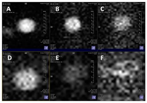 Functionalized Gold Nanoparticles as Contrast Agents for Proton and ...