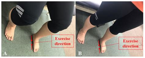 Effects of Two Foot-Ankle Interventions on Foot Structure, Function ...