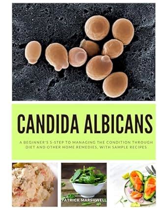 Candida Albicans: A Beginner's 5-Step to Managing the Condition Through ...