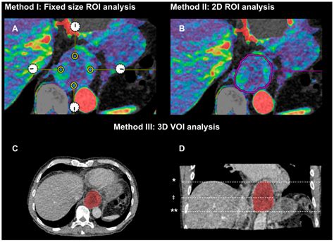 Interobserver and Intraobserver Reproducibility with Volume Dynamic ...