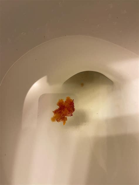 Poop That Looks Like Mucus - Infoupdate.org