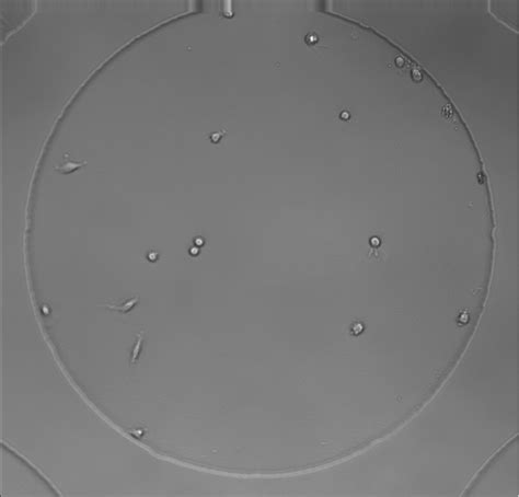 Python Microscope Image Processing 的图像结果