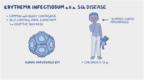 Fifth Disease
