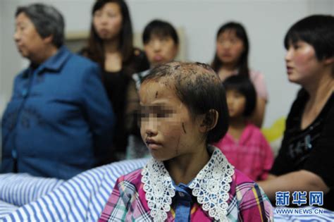贵州虐女童事件追踪 专家称致重伤死亡才可公诉-搜狐新闻
