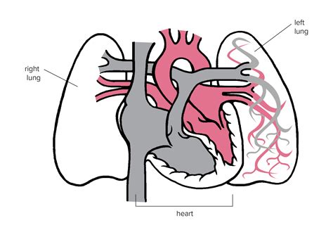 Diagram of the heart and lungs | Children’s Heart Network