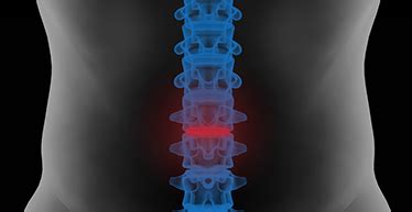 All About Brain Care & Spine Care | Dr. Lalit Bhardwaj