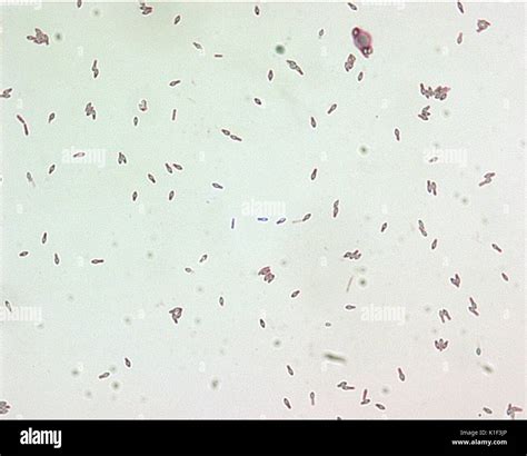 Clostridium Spore Stain